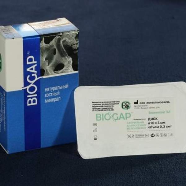 Биоимплант ГАП 1-2 мм 2-4 мм. 0.5 см3 - костный заменитель