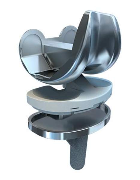 Эндопротез коленного сустава ООО "Титанмед"