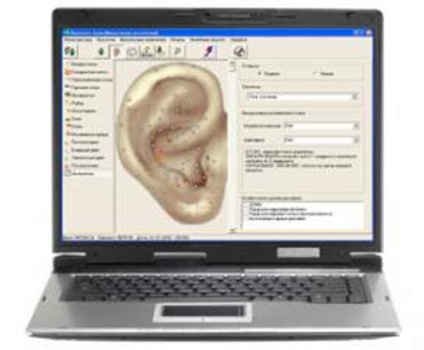 Компьютерный комплекс аурикулярной диагностики,  программа ПЕРЕСВЕТ АУРИ версия 2. 5