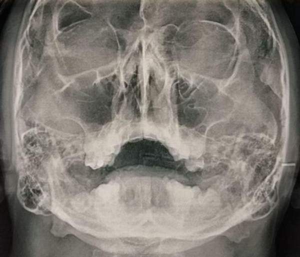 Рентгенoдиагностика