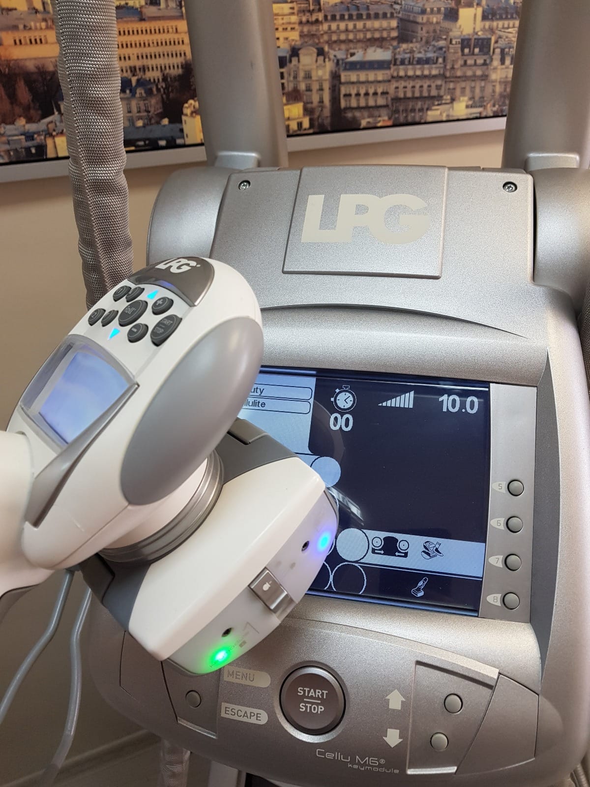 Аппарат LPG для массажа cellu m6 keymodule 1 — фото 3