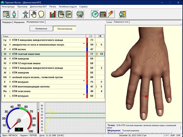 биотест прибор для метода Фолля.      Электропунктурная диагностика и терапия.      Компьютерная программа пересвет фолль — фото 2