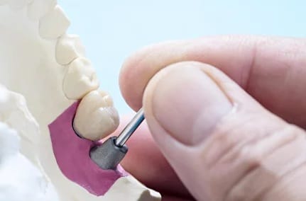 Закрытый синус лифтинг