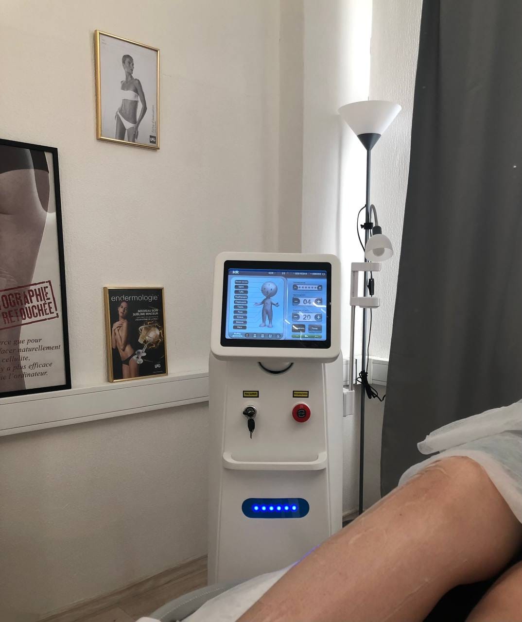 Диодный лазер для эпиляции в аренду — фото 2