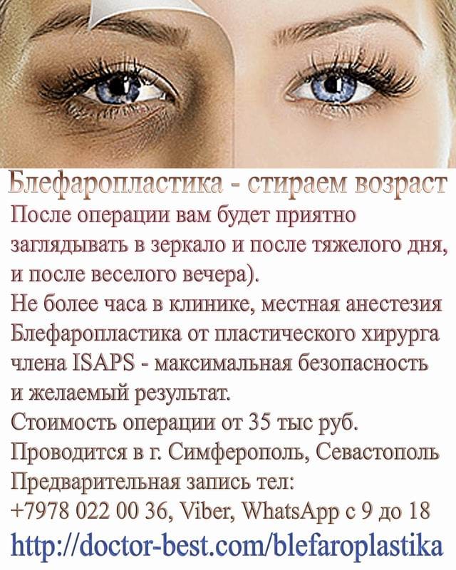 Блефаропластика вернёт лицу здоровый внешний вид и избавит от проявлений усталости
