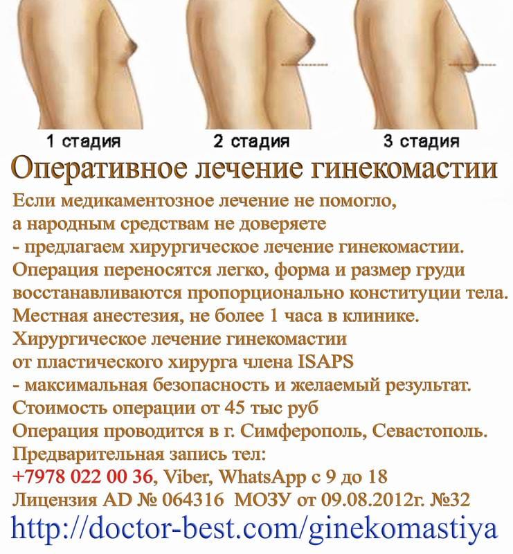 Оперативное лечение гинекомастии. Крым.