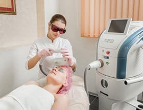 Удаление пигментных пятен на лице — фото 2