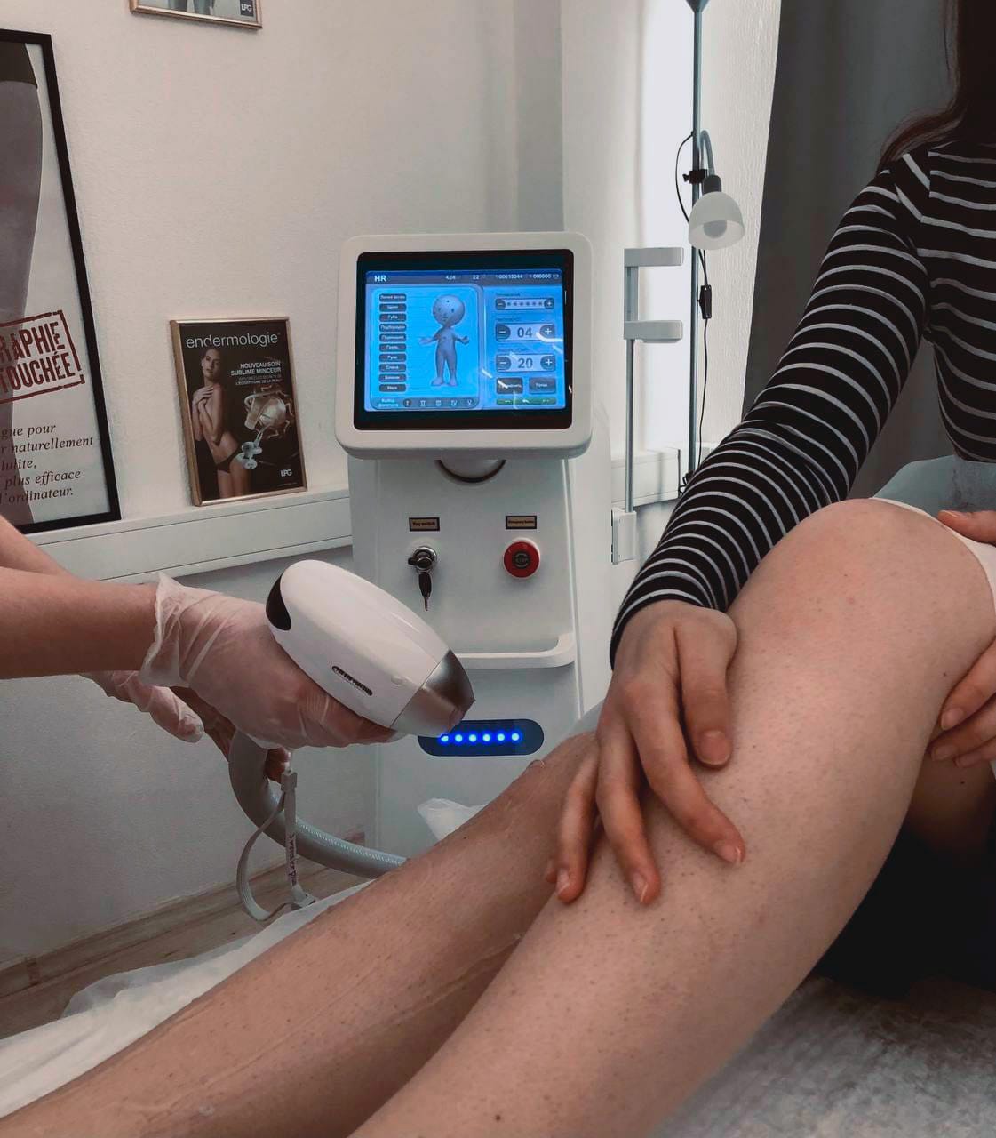 Диодный лазер для эпиляции в аренду — фото 6