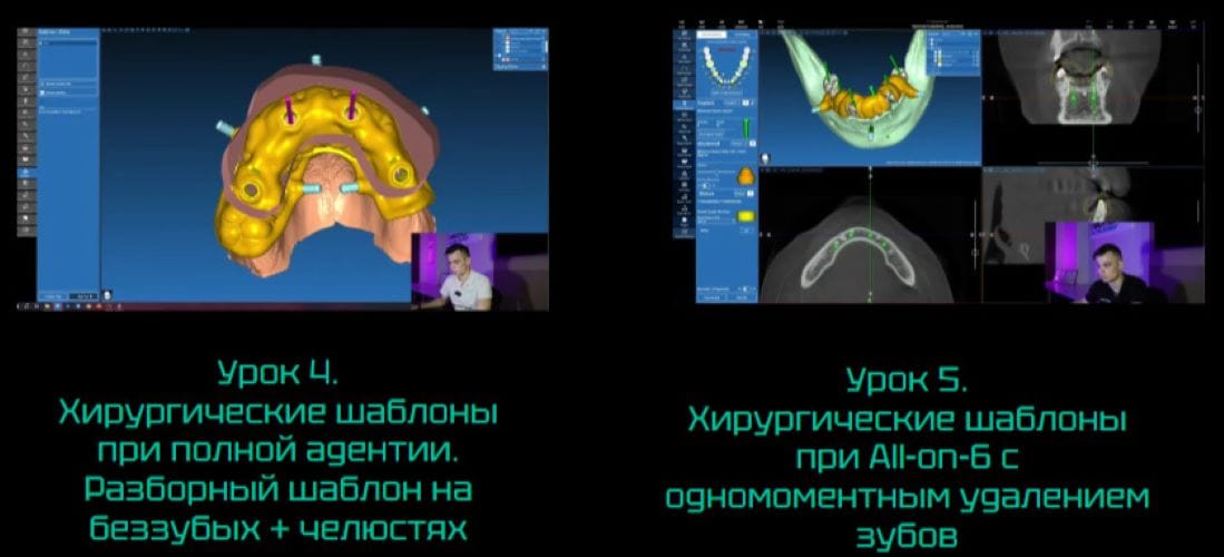 Образовательный курс по хирургическим конструкциям в системе RealGuide